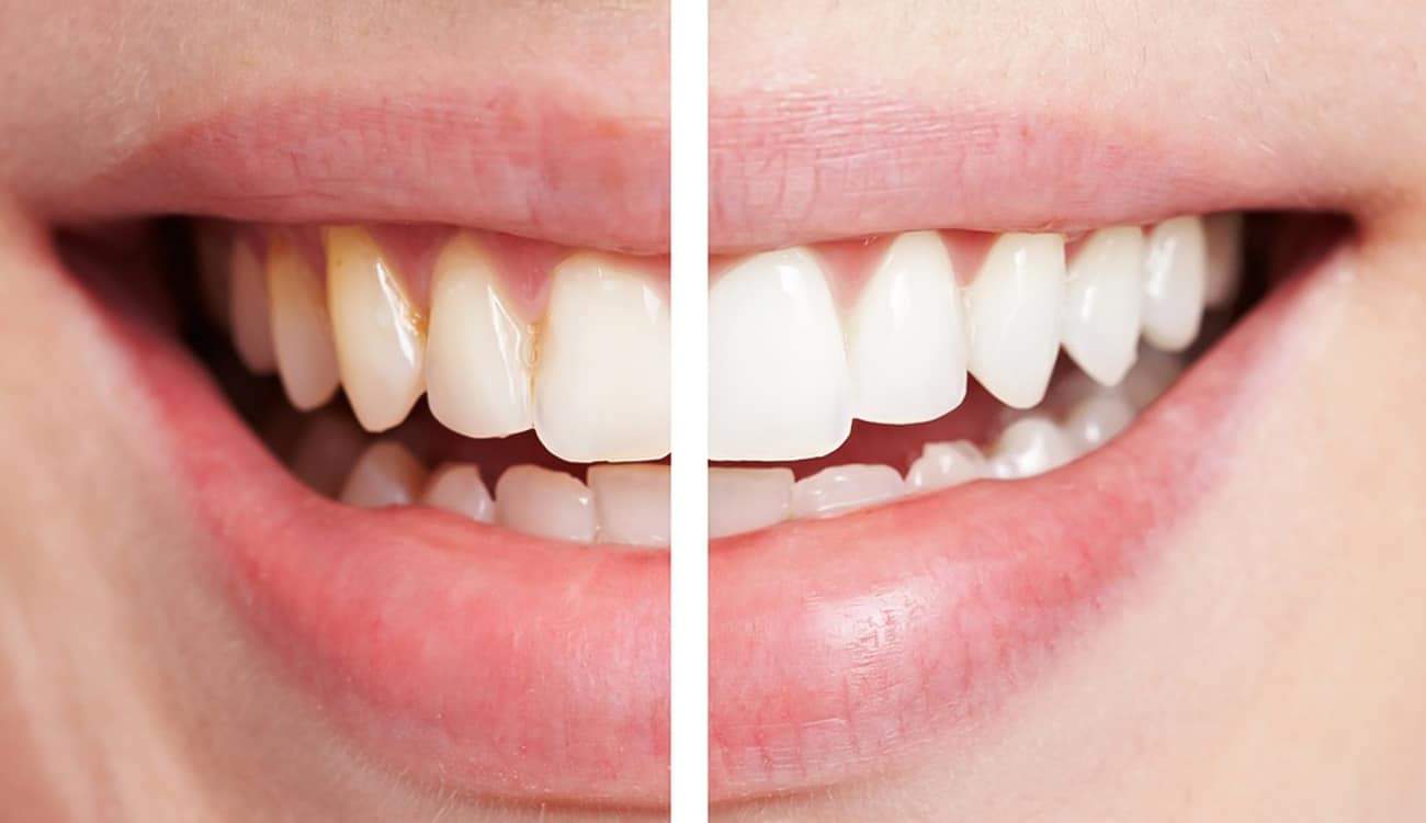 Bột than tre giúp làm trắng răng hiệu quả