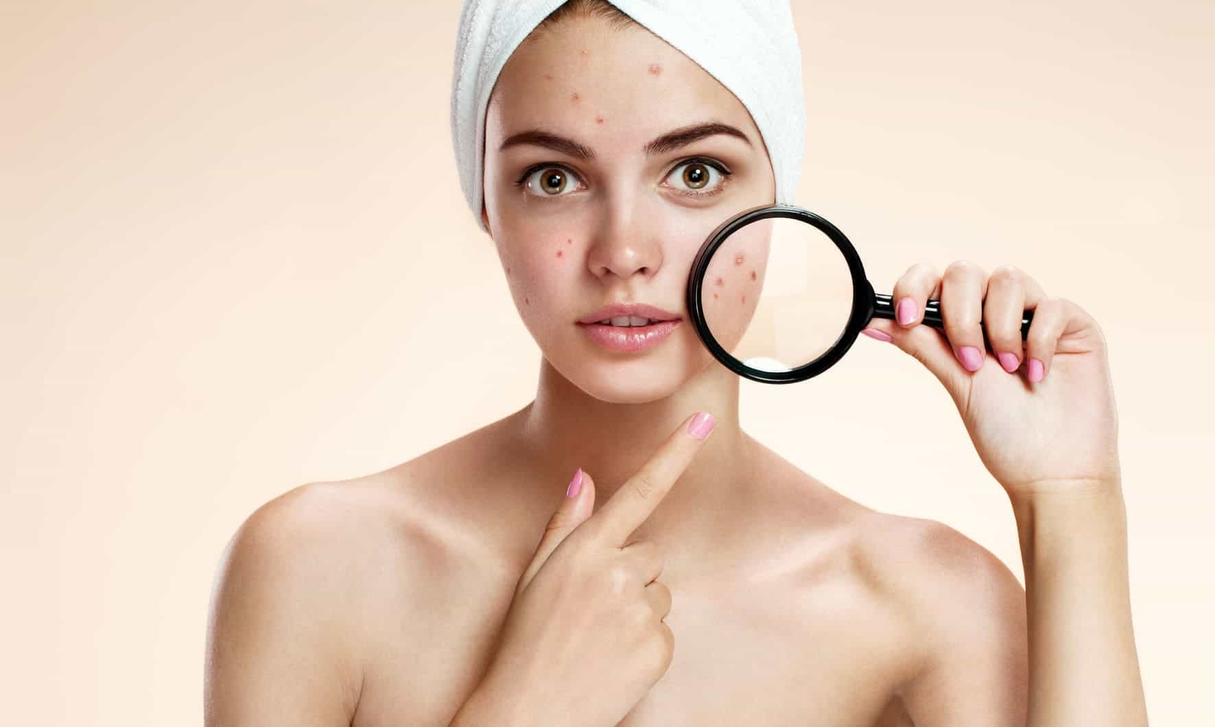 Nguyên nhân dẫn đến việc da mặt bị dị ứng mỹ phẩm có thể do sử dụng mỹ phẩm không phù hợp với loại da