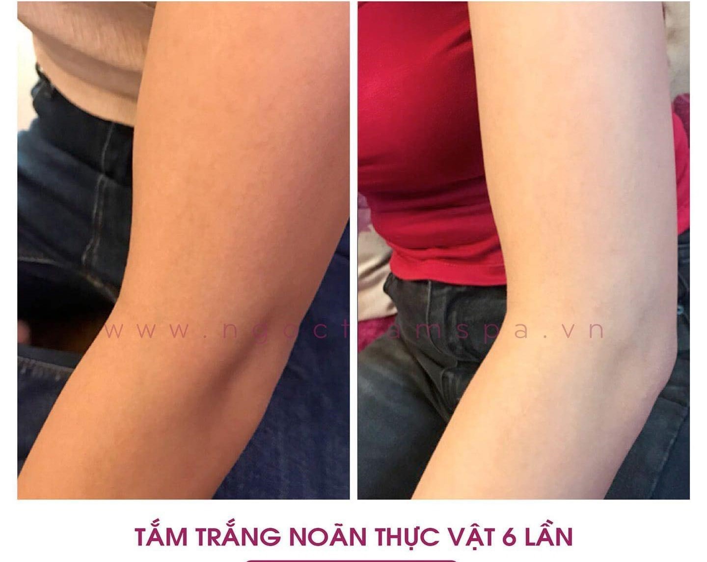 Địa Chỉ Tắm Trắng Uy Tín Tại Đà Nẵng