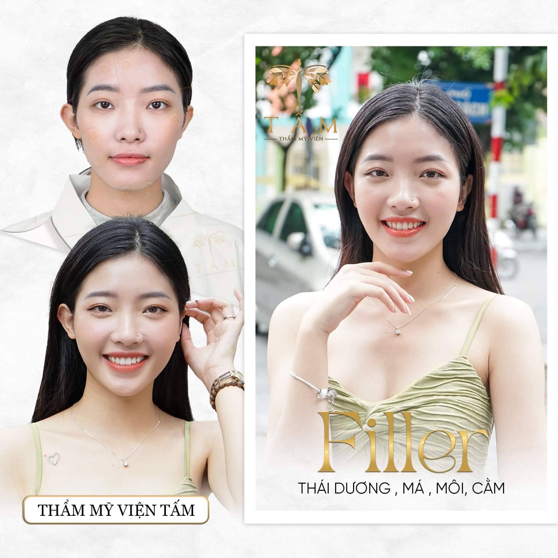 Thẩm Mỹ Viện Uy Tín Ở Sài Gòn