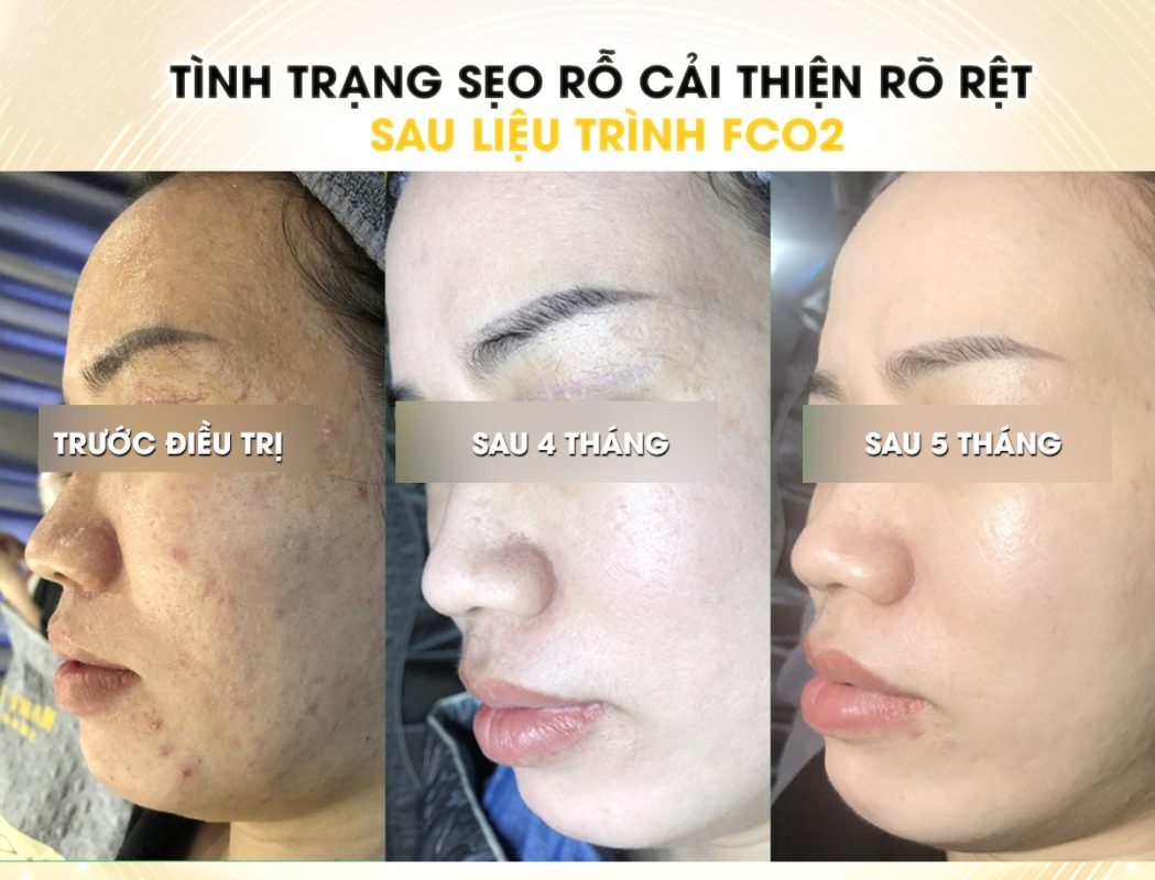 Miss Tram