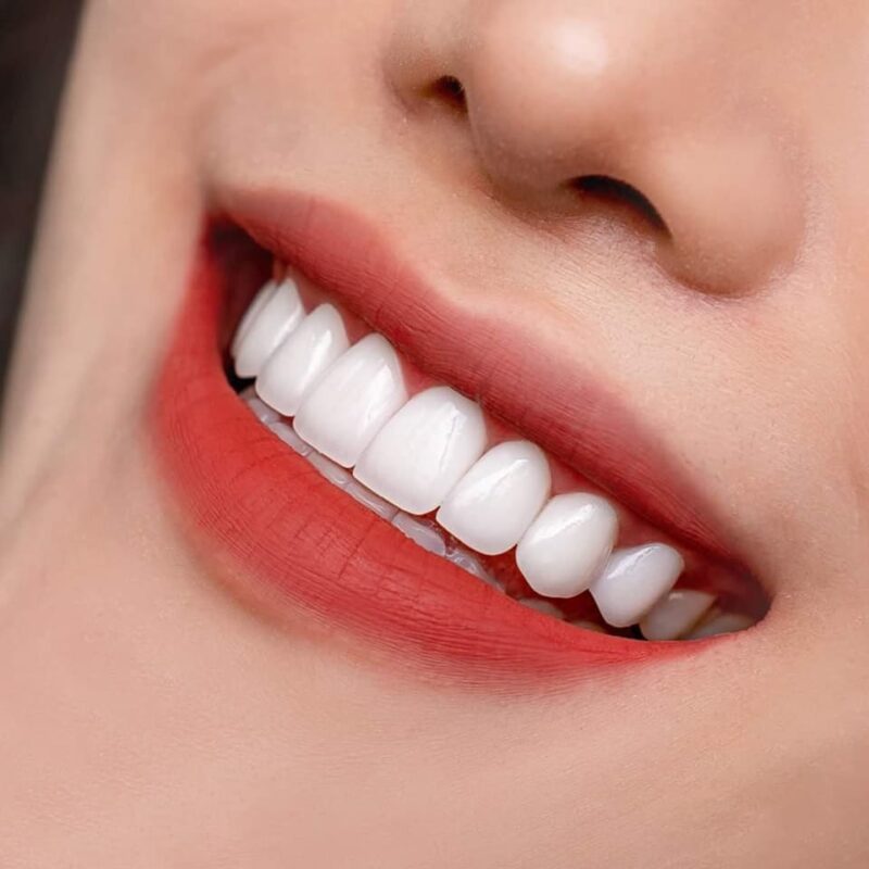 nơi bọc răng sứ ở Đà Nẵng