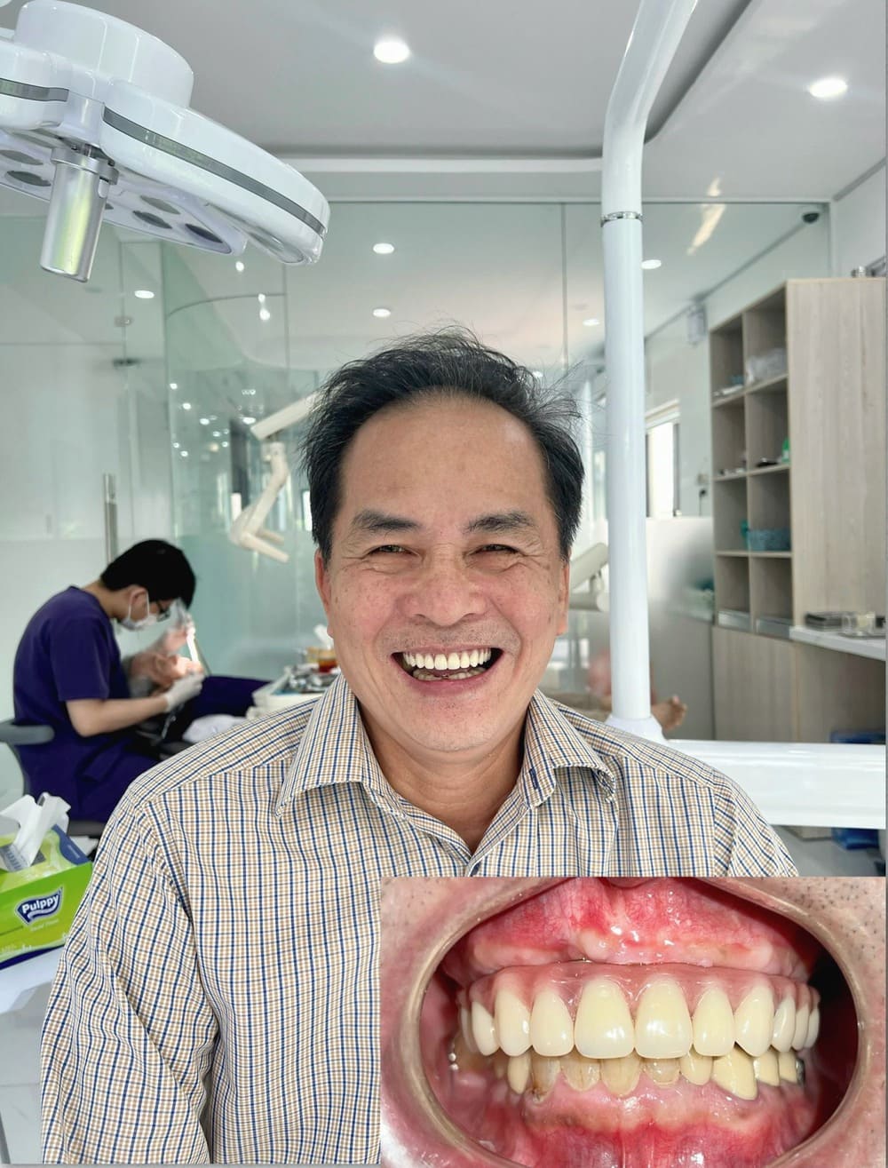 tẩy trắng răng tại Đà Nẵng
